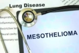 A man files a mesothelioma lawsuit due to asbestos exposure at work